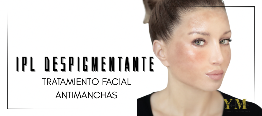 IPL despigmentante en Centro de Belleza Dori en Motril (Granada)